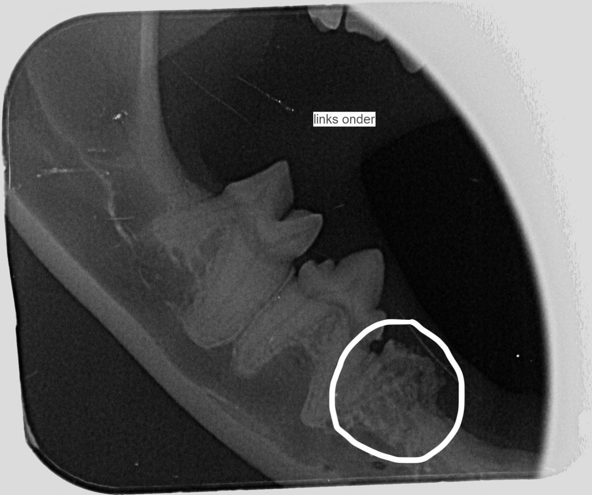 Dentale-RX-met-resorptie-wortel-1200x1004